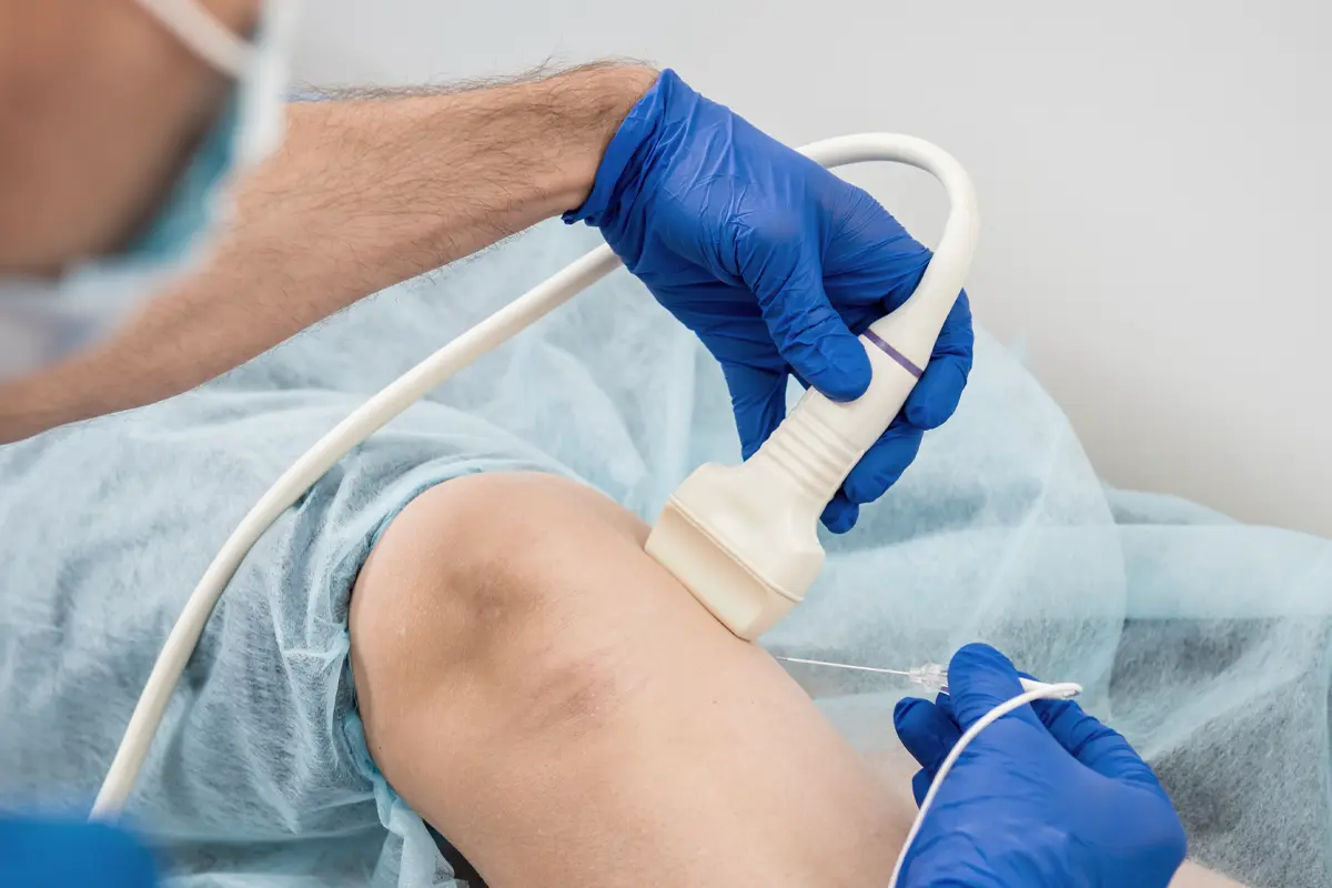 Interventional Radiology in the knee